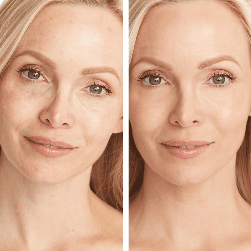 VelvetPro - Creme Facial e Corporal Que Corrige Manchas, Hidrata e Rejuvenesce a Aparência da Pele