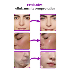 CollagenPro - Máscara de Colágeno Que Hidrata Profundamente e Restaura a Elasticidade (Pincel Aplicador Brinde)